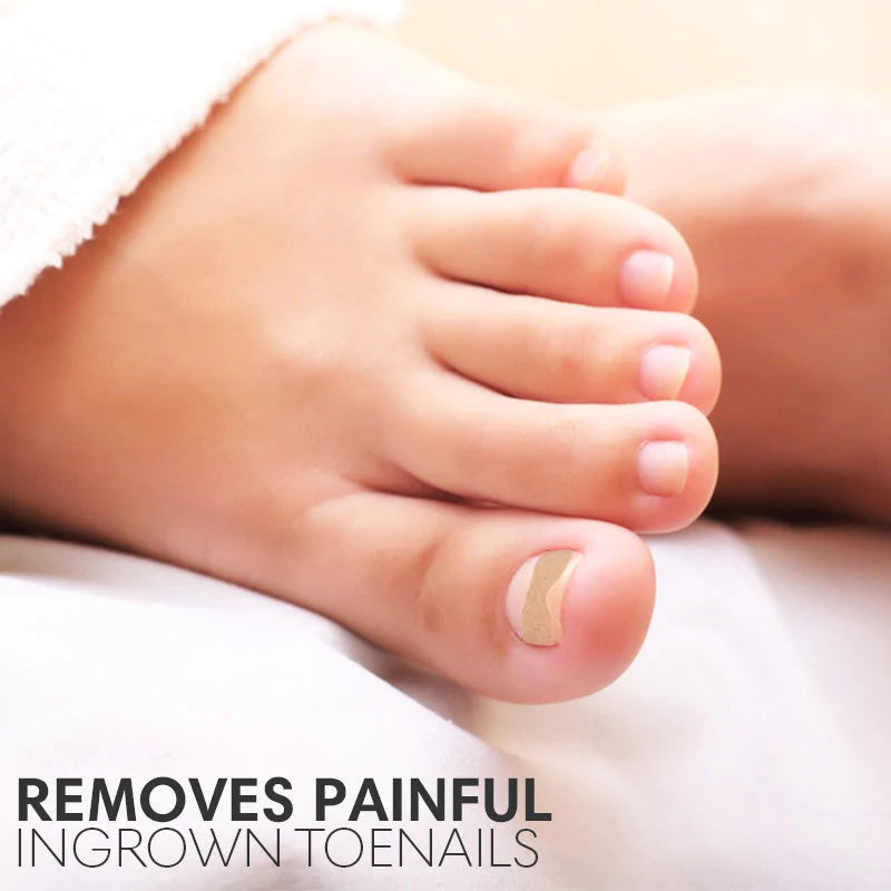 Step by step visual guide on how to apply the toenail patch