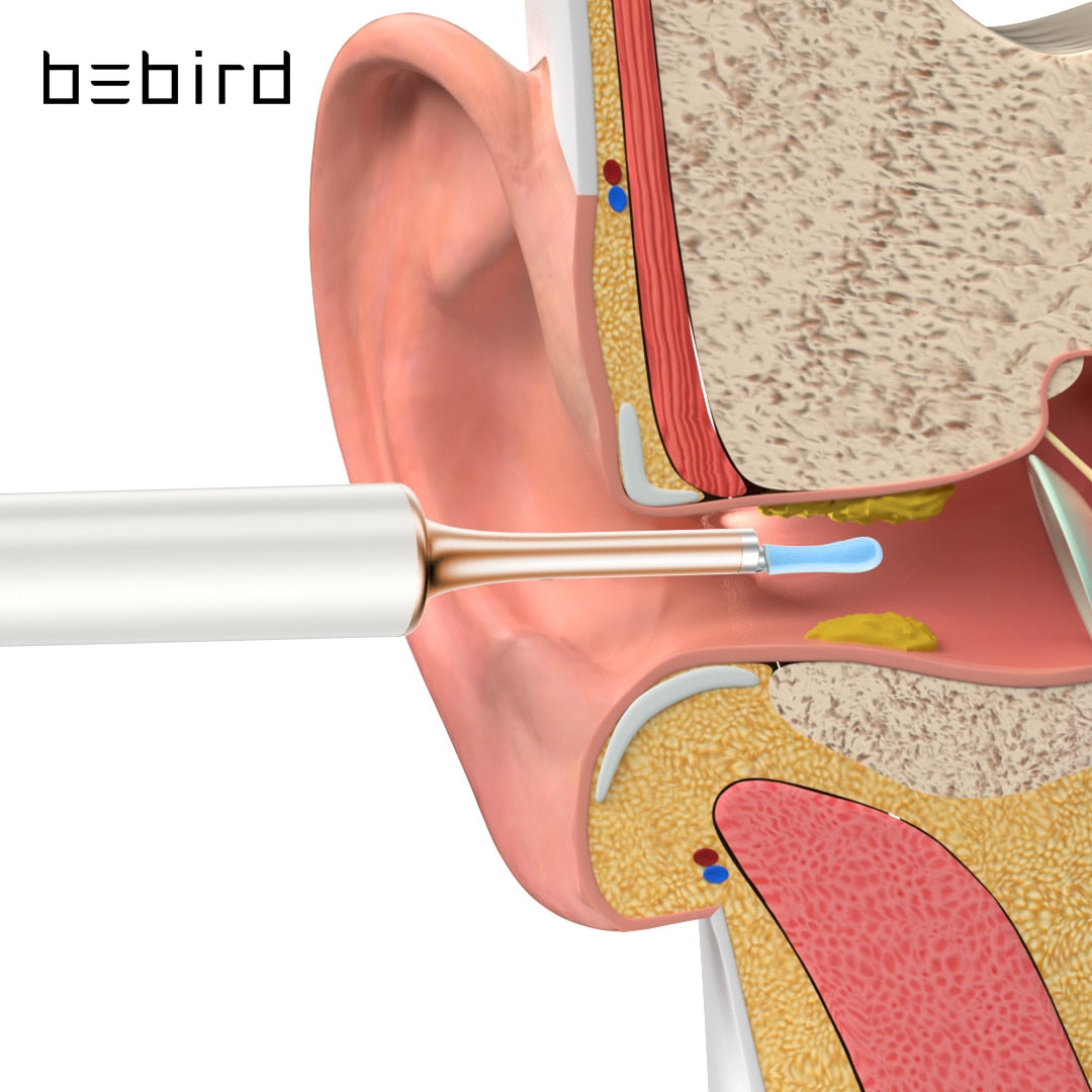 Wireless Endoscope HD Ear Pick - Starqon