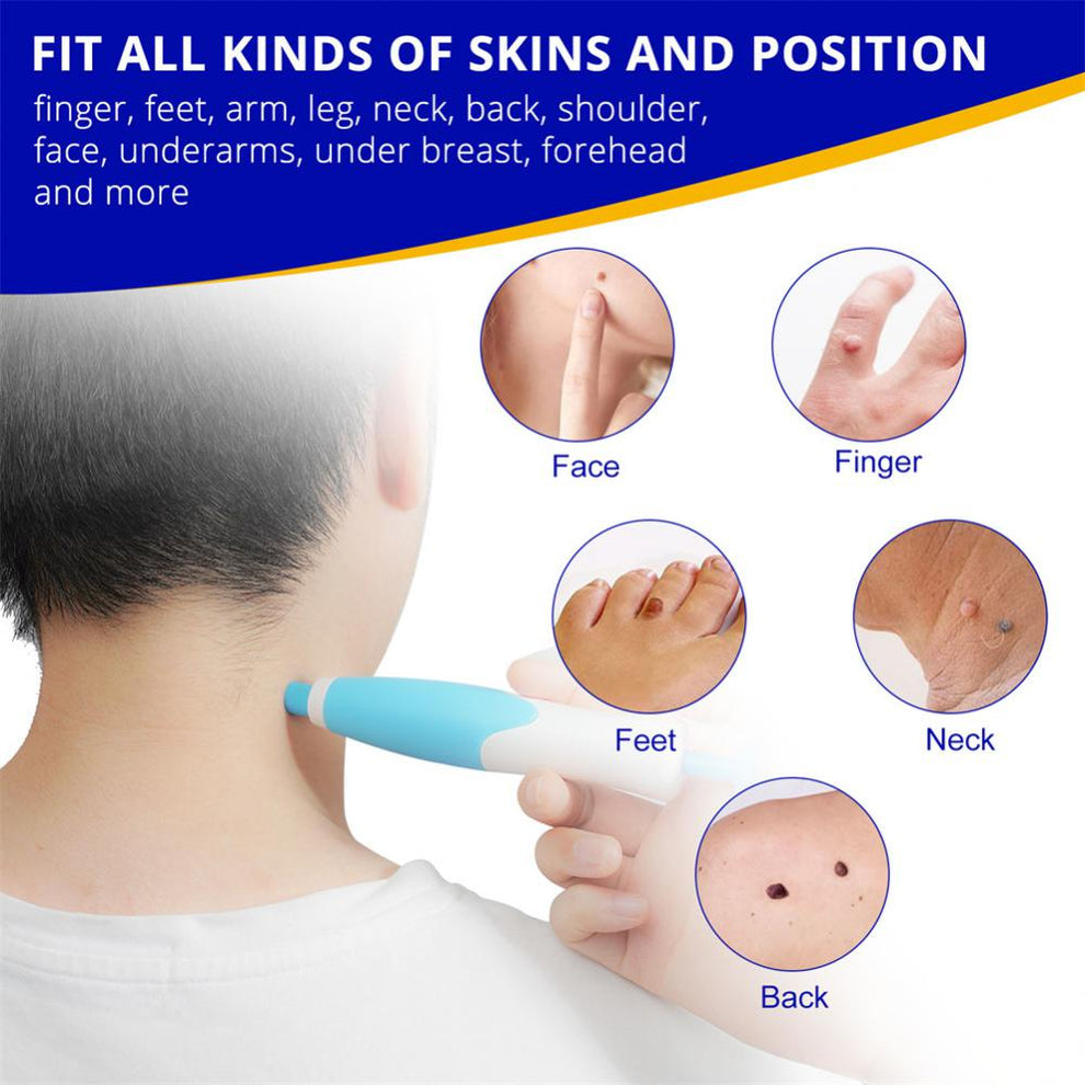 Step-by-step diagram showing how to position the band with the applicator.