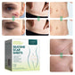 Silicone Scar Patch Removal - Starqon