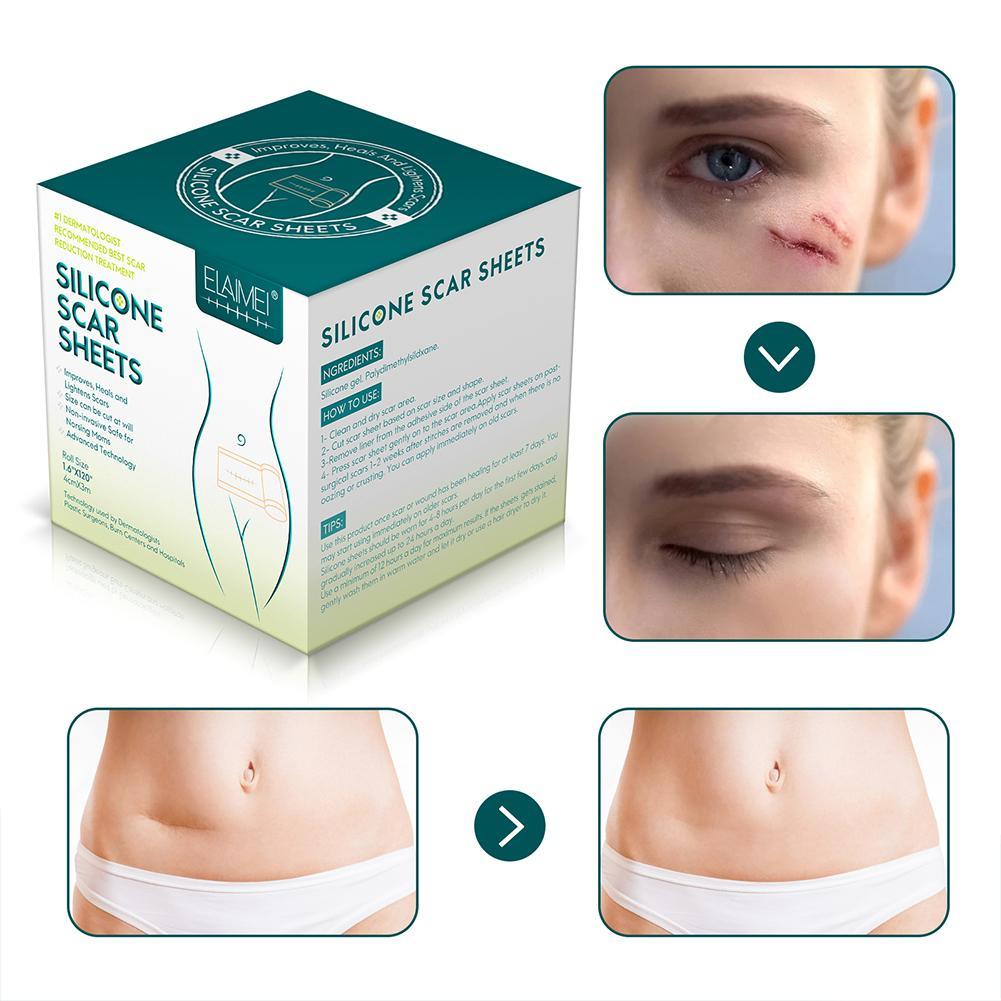 Silicone Scar Patch Removal - Starqon