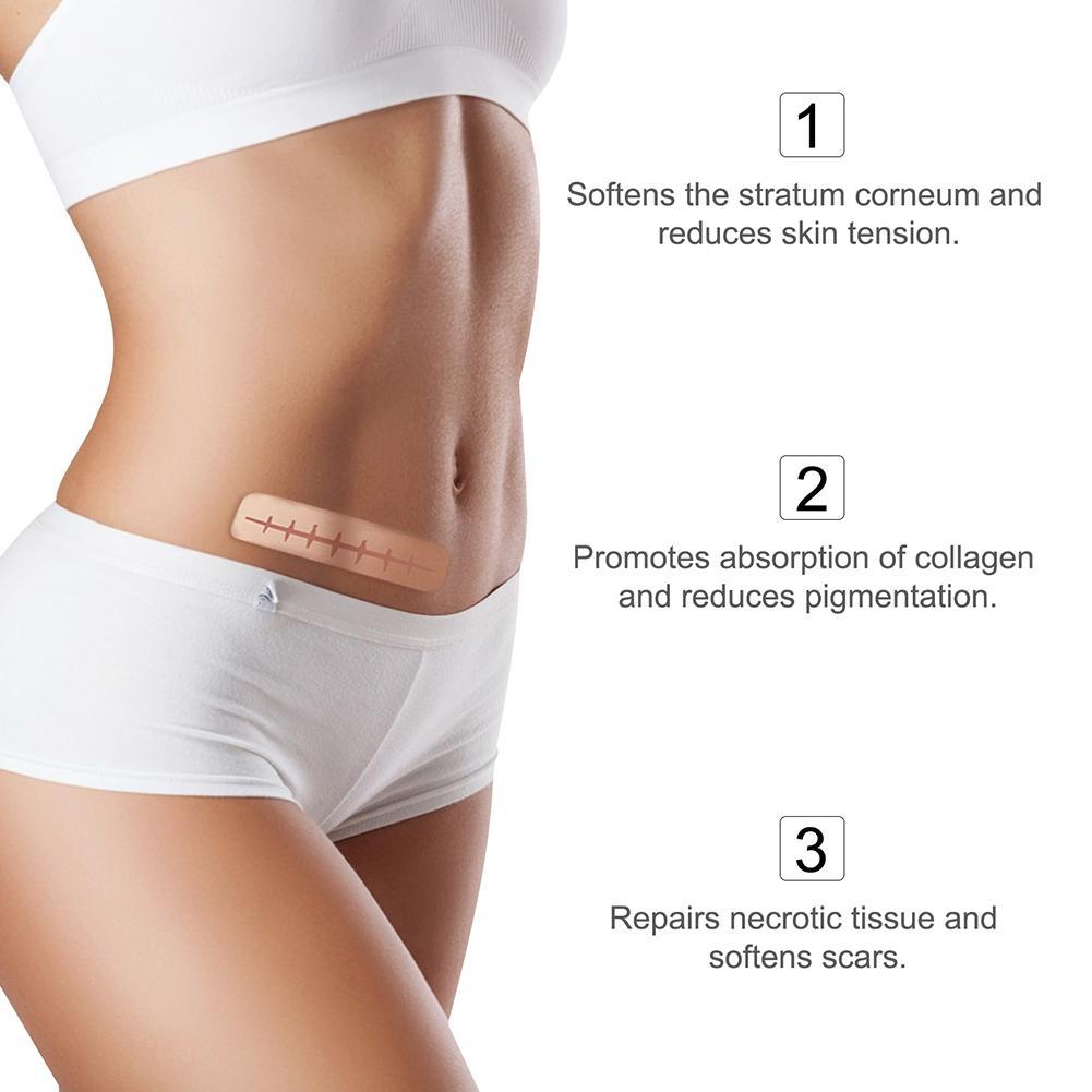 Silicone Scar Patch Removal - Starqon