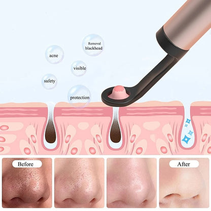 Wireless Endoscope HD Ear Pick - Starqon