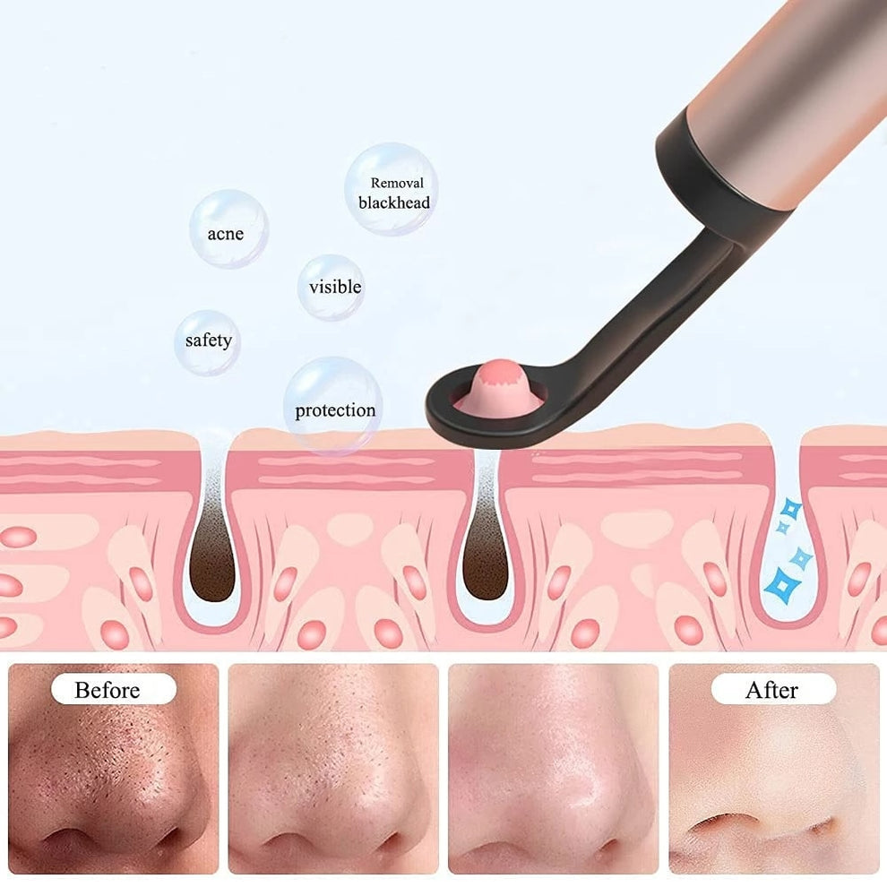 Included replacement ear tips and accessories